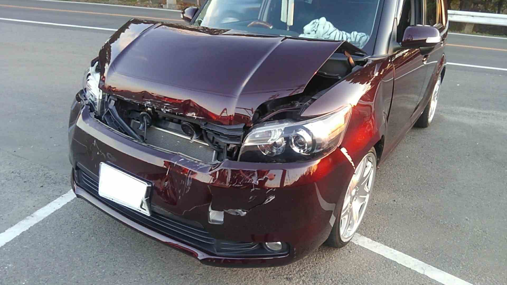 ④ こんな不安（交通事故_整形2）イメージ